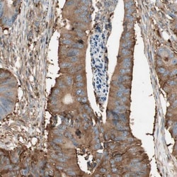 Integrin beta-like protein 1 Antibody, Novus Biologicals 25 &mu;L; Unlabeled:Antibodies,
